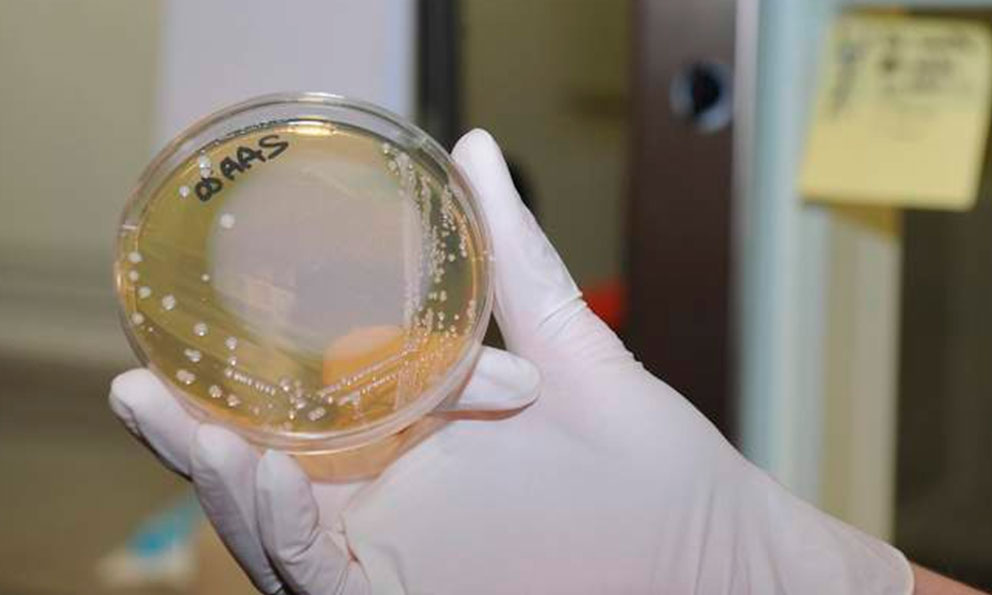 Alertan aumento de casos de una ‘bacteria carnívora’ que está afectando a Japón
